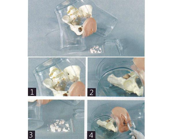 高級透明刮宮模型圖片