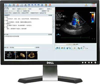 供應(yīng)超聲影像工作站