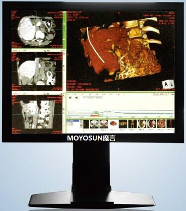 供应魔言1MP彩色显示器B超显示器X光机显示器CT显示器灰阶显示器