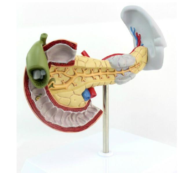胰腺十二指肠和胆囊病理模型图片