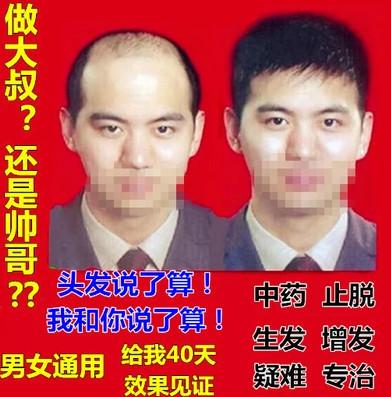 供应用于的女人生完孩子掉头发脱发防脱脉塔瑶元堂